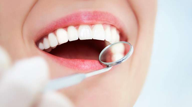 dental cleaning mitcham vic