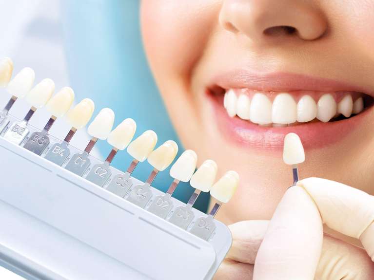 teeth whitening kit