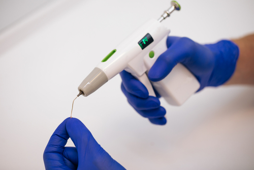 Modern,Technology.,Obturation,Of,Root,Canals,During,Endodontic,Treatment.,Endodontic